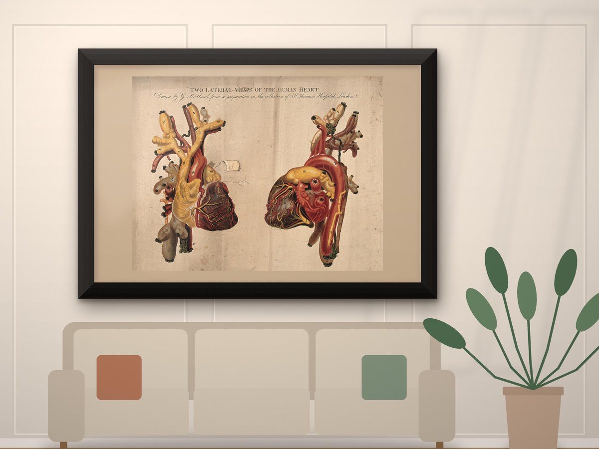 G. Kirtland 1806 Anatomical Heart Engraving, Two Lateral Views of the Human Heart, Medical Poster, Science Wall Art